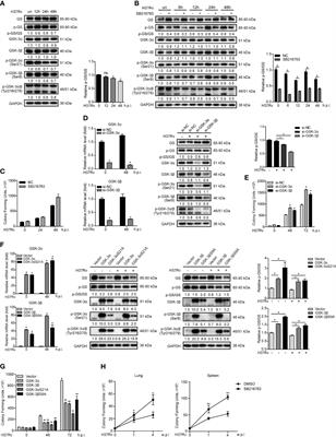 GSK-3α/β Activity Negatively Regulates MMP-1/9 Expression to Suppress Mycobacterium tuberculosis Infection